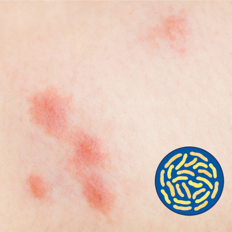 Polvere umana Premix Probiotici Ridurre l'infezione per bambini e infantili